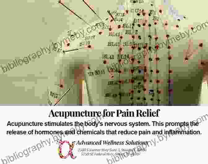 Acupuncture For Pain Management The Mindbody Prescription: Healing The Body Healing The Pain